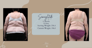 Female Weight Loss Before and After Before and After Woman in Virginia Beach Losing Weight Body Fat from Semaglutide Weightloss Shots