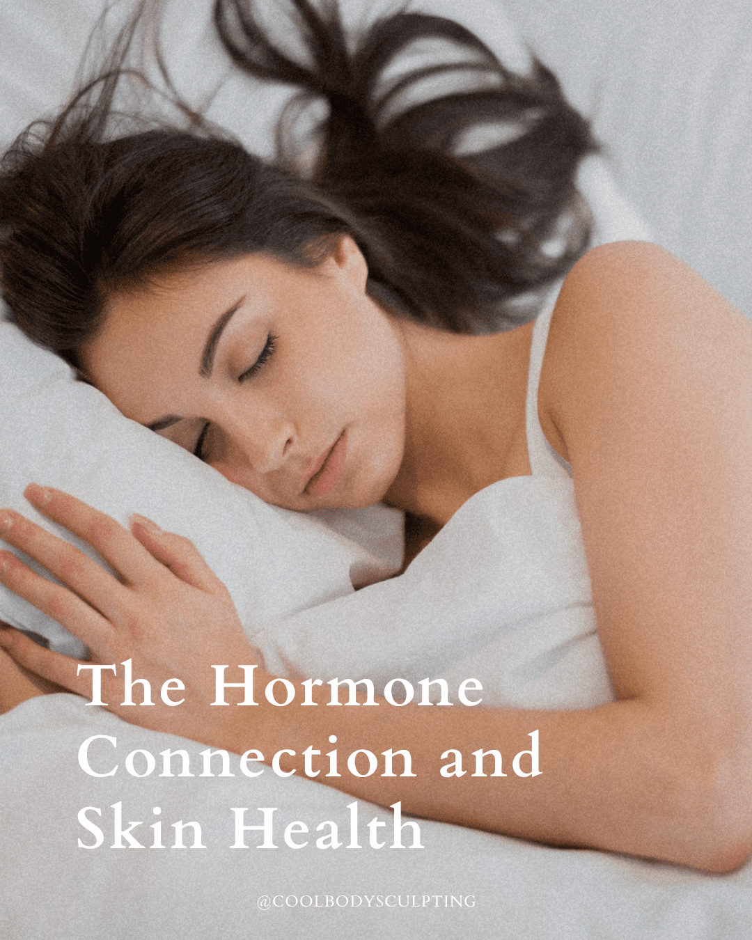 The Hormone Connection and Skin Health Woman sleeping in a white bed illustrating the hormone connection and skin health for beauty sleep benefits in Virginia Beach.