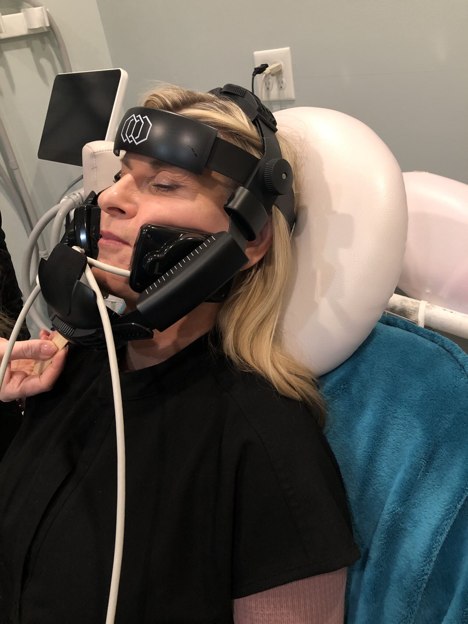 InMode Define Non-Surgical Face Lift | Virginia Beach Woman receiving InMode Define non-surgical face lift treatment at Cool Body Sculpting Center in Virginia Beach to tighten skin and define facial contours.